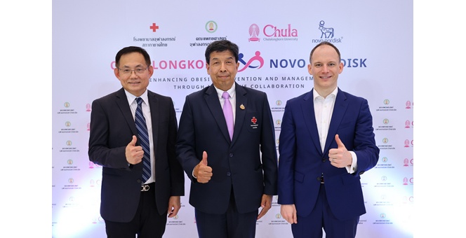 จุฬาลงกรณ์ ผนึกกำลัง โนโว นอร์ดิสค์ เปิดตัวความร่วมมือครั้งประวัติศาสตร์ ยกระดับการจัดการโรคอ้วนด้วยนวัตกรรม